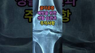 골다공증, 예방을 위한 생활습관과 주의사항