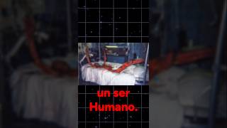 THE CRUELEST EXPERIMENT IN SCIENCE | The Hisashi Ouchi Case