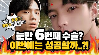 눈 재수술만 5번 한 남자의 마지막 수술 도전!