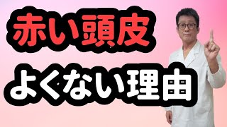 【頭皮の色をチェックしよう！】赤い頭皮はダメですよ！202208023 東京都 目黒区 武蔵小山 発毛 育毛 薄毛 薄毛治療 AGA ハゲ