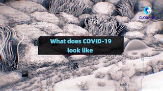 GLOBAlink|What does COVID-19 really look like