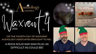 ROCK SOLID EAR WAX PLUG REMOVAL - EP689