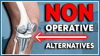 5 Non-Operative Alternatives to Knee Replacement: What You Need to Know