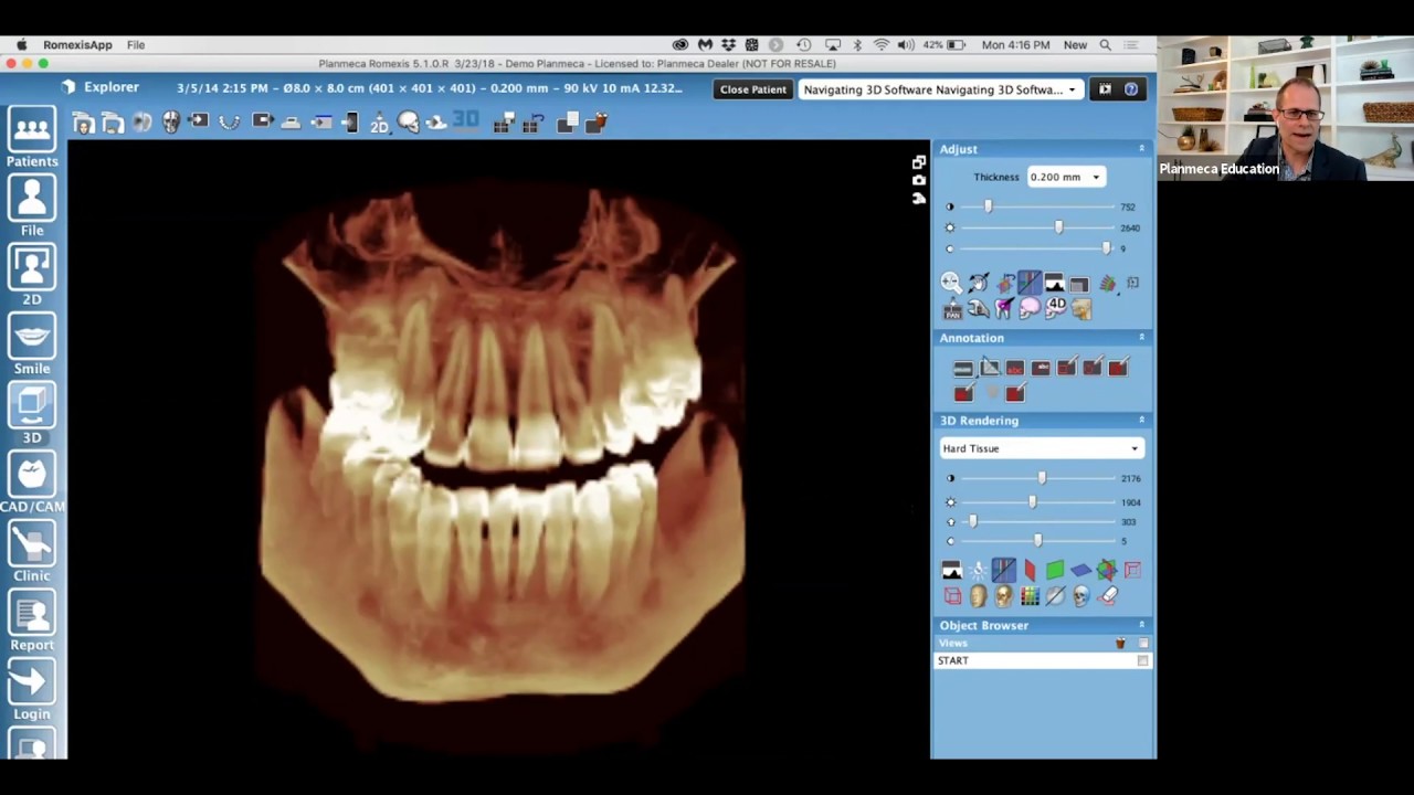 3d Imaging Software Navigating In A 3d Space Youtube