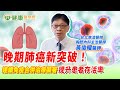 晚期肺癌新突破！連續免疫合併治療顯著提升患者存活率【黃俊耀醫師】