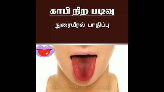 What Your Tongue Has to Say About Your Health |உங்கள் ஆரோக்கியத்தைப் பற்றி உங்கள் நாக்கு என்ன சொல்ல