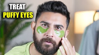 HOW TO TREAT PUFFY EYES | DARK CIRCLES | TIRED EYES | Under Eye Bags | Under Eye Patches | DSBOSSKO