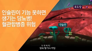 인슐린이 기능 못하면 생기는 당뇨병! 혈관합병증 위험 - (2016.12.14_604회 방송)_암보다 무서운 혈관병 당뇨합병증