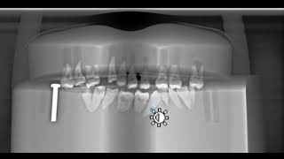 RAYSCAN Alpha Software Demo | Used Dental Panoramic X-ray System