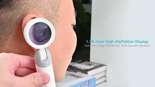 2025 SUNUO Q10 Digital Otoscope 1080P HD Screen See Clearly Inside Your Ear Canal for Medical Use