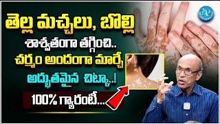 Home Remedies For White Patches On Skin - Causes \u0026 Symptoms | Latest Health Tips In Telugu || iDream