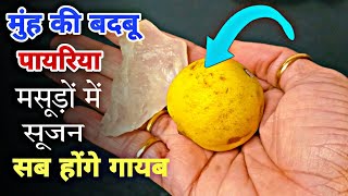 मुंह से बदबू, पायरिया, मसूड़ों में सूजन का 100% पक्का घरेलू इलाज, How to cure Payariya Muh ki badbu