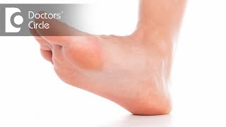 What can cause painful red dot on foot? - Dr. Mohan M R