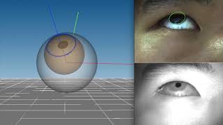 Pupil and Iris Tracking using a RGB-IR Camera