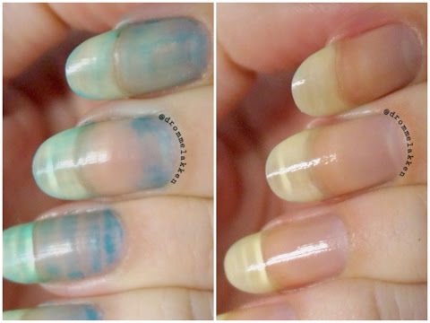 How to remove serious nail stains! How to remove serious nail stains!