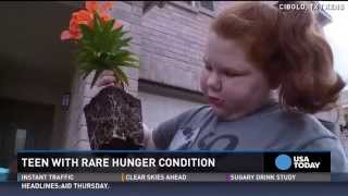 Rare condition caused teen to gain 150 pounds