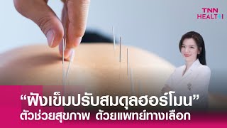 “ฝังเข็มปรับสมดุลฮอร์โมน” ตัวช่วยในการดูแลสุขภาพ ด้วยแพทย์ทางเลือก : TNN Health