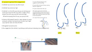 RCA engagement: the 11 pitfalls + troubleshooting