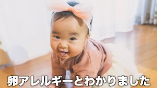 ゆねちゃんの卵アレルギーについてお話ししておきます！【生後９ヶ月赤ちゃん】Yune is allergic to eggs.