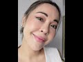 คุณจ๋า ผู้จัดการดารา แก้ไขหนังตาตกด้วยเทคนิคซ่อนแผลใต้คิ้ว sub brow lift ที่ 𝐖 𝐇𝐨𝐬𝐩𝐢𝐭𝐚𝐥 ‼