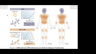 Telecapacitación 2021: Terapia neoadyuvante en melanoma maligno