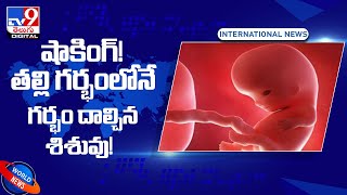 షాకింగ్‌! తల్లి గర్భంలోనే గర్భం దాల్చిన శిశువు! - TV9