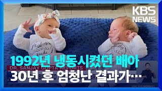 [글로벌K] 30년 된 냉동 배아에서 태어난 쌍둥이 남매! / KBS  2022.11.29.