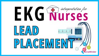 ECG for Nurses: 3, 5 and 12 Lead Placement (electrocardiogram)
