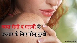 त्वचा रोगों व एलर्जी के उपचार के लिए घरेलू नुस्खे - Onlymyhealth.com