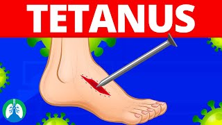 Tetanus (Medical Definition) | Quick Explainer Video