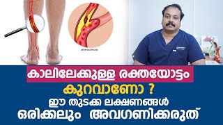 കാലിലേക്കുള്ള രക്തയോട്ടം കുറവാണോ ? ഈ തുടക്ക ലക്ഷണങ്ങൾ അവഗണിക്കരുത് | Peripheral Vascular Disease