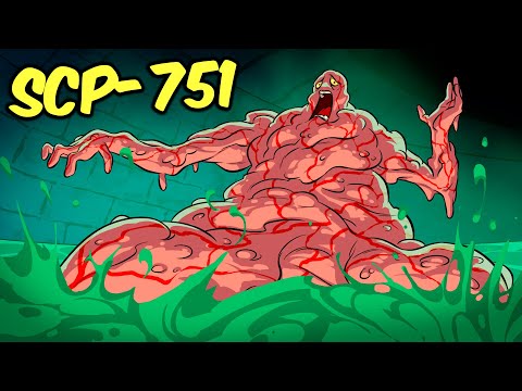 SCP-751 – Organ Eater