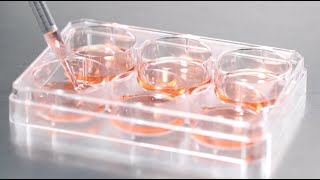 Cell Contamination: What you may be overlooking