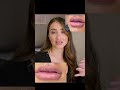 lip filler removal replace *before and afters included* dr. ghavami