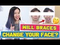 Will Braces Change Your FACE? | #BraceYourself​!🦷