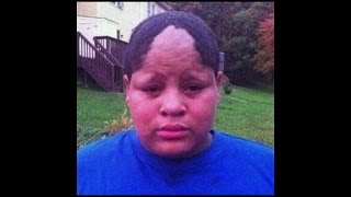 Funny Hairline Fails