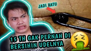 CONGKEL KOTORAN UDEL TERBESAR DI DUNIA | ngelondry udel pusar kotor🤮