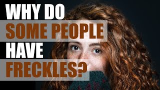 Why Do Some People Have Freckles?