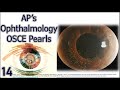 AP's Ophthalmology OSCE Pearls 14