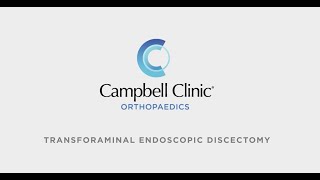 Transforaminal Endoscopic Discectomy at Campbell Clinic Orthopaedics