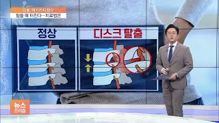 [의술, 이게 최신] 명절에 유독 많은 '허리 삐끗'…디스크 치료법은?