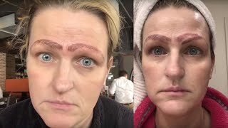 MICROBLADING FAIL: Woman has 4 eyebrows