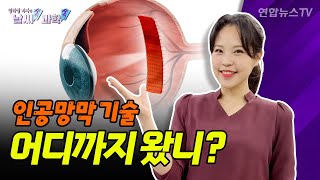 [날씨쏙 과학쏙] 시각장애인 새로운 눈 되어줄 '인공망막' 기술, 어디까지 왔을까? / 연합뉴스TV (YonhapnewsTV)