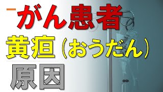 がん患者にみられる黄疸（おうだん）の原因とは？黄色くなったら注意！