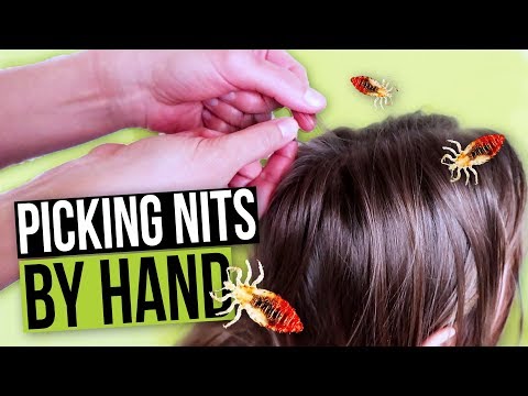 Can you pull lice eggs out with your fingers?