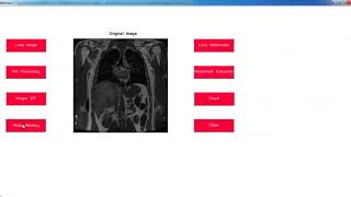 Projects on Image Processing with Source Code | Thesis on Image Processing with Source Code