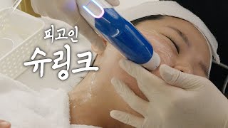 얼굴 작아지는 법 | 심부볼, 팔자주름 '슈링크'로 해결(시술과정포함)  | 피고인의 삶