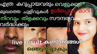 🔥എത്ര കറുപ്പായവരും വെളുക്കും live result കണ്ട് നിങ്ങൾ ഞെട്ടിപ്പോകും#skinwhitening