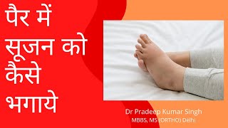 पैर में सूजन का इलाज /Dr. Pradeep Kumar Singh