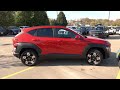 2025 hyundai kona sel vs kia seltos s side by side comparison